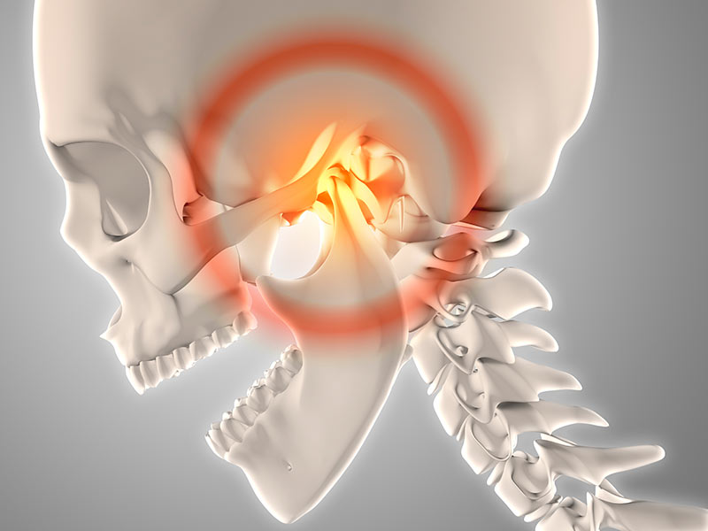 Disfunção Temporomandibular