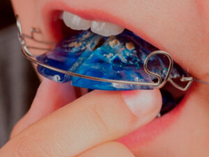 ortopedia funcional dos maxilares