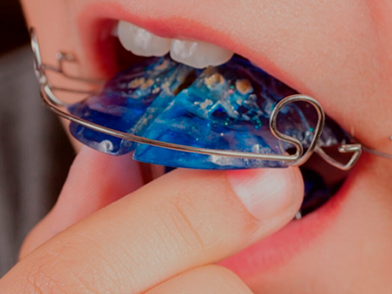 ortopedia funcional dos maxilares