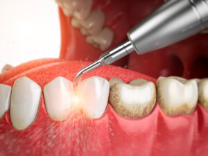 periodontia